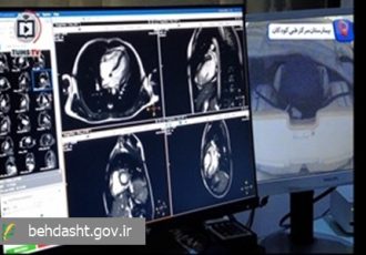 پایان ارجاع بیماران قلبی کودک/ MRI قلب در مرکز طبی کودکان راه‌اندازی شد