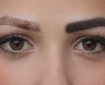 عوارض پاک کردن تاتو ابرو با لیزر {۵ عوارض مهم و تجربی}