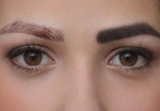 عوارض پاک کردن تاتو ابرو با لیزر {۵ عوارض مهم و تجربی}