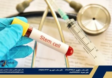 درمان آرتروز زانو با تزریق سلول‌های بنیادی؛ آیا می‌توان جراحی را به تعویق انداخت؟