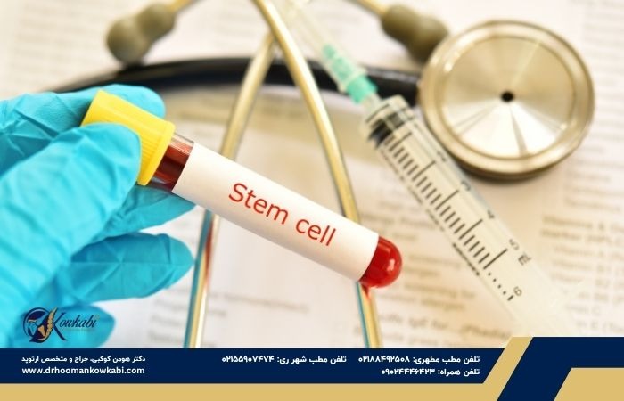 درمان آرتروز زانو با تزریق سلول‌های بنیادی؛ آیا می‌توان جراحی را به تعویق انداخت؟