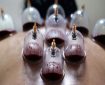 حجامت توسط افراد غیر متخصص خطرناک است