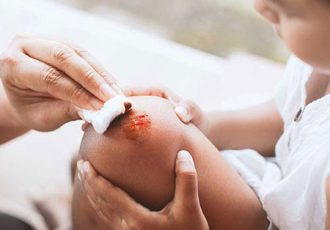 راههای تشخیص و درمان عفونت زخم
