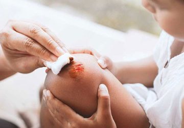 راههای تشخیص و درمان عفونت زخم