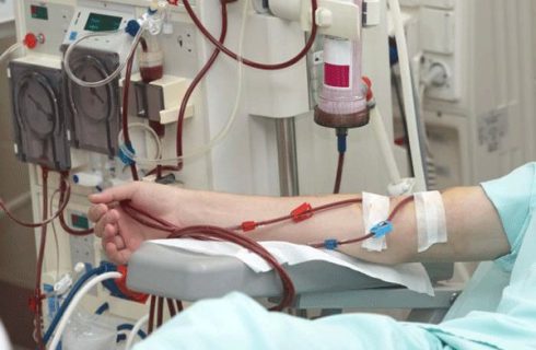 روش ساده خنثی کردن «مه مغزی» در بیماران شیمی درمانی