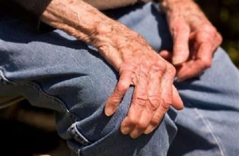 مشکل هورمون درمانی برای بیماران جراحی مفصل زانو