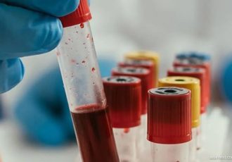 پیش بینی خطر عود سرطان خون با آزمایش ژنتیک