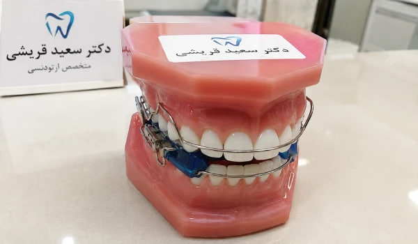 انواع ارتودنسی ارتودنسی فانکشنال