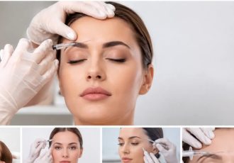 ترمیم بوتاکس چیست؟ بهترین زمان ترمیم بوتاکس و هر آنچه باید بدانید