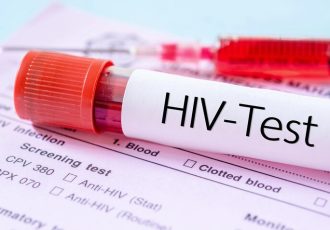 مهم‌ترین چالش امروز HIV در ایران