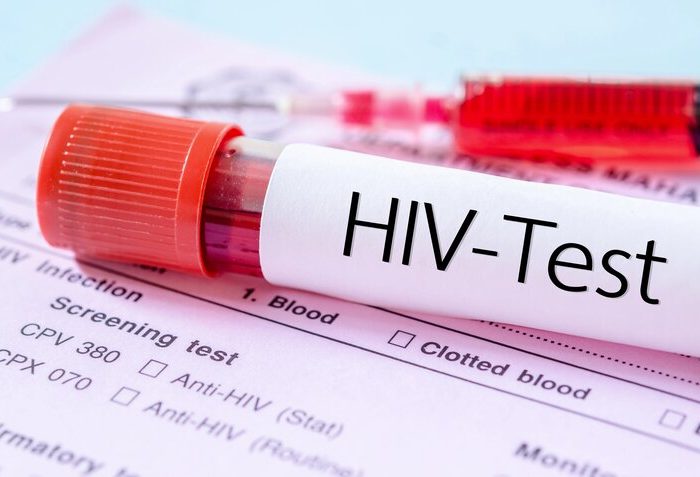 مهم‌ترین چالش امروز HIV در ایران