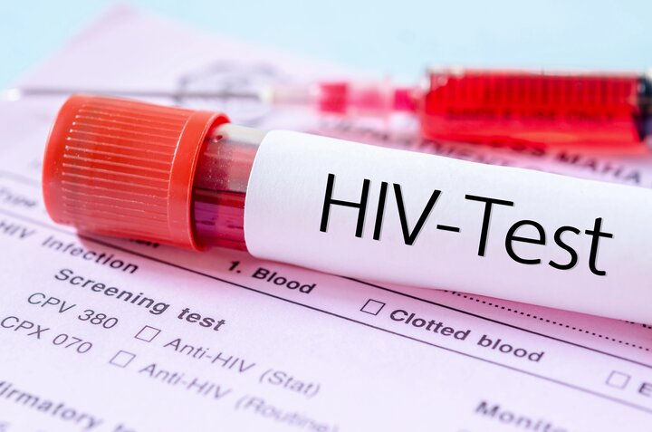 مهم‌ترین چالش امروز HIV در ایران