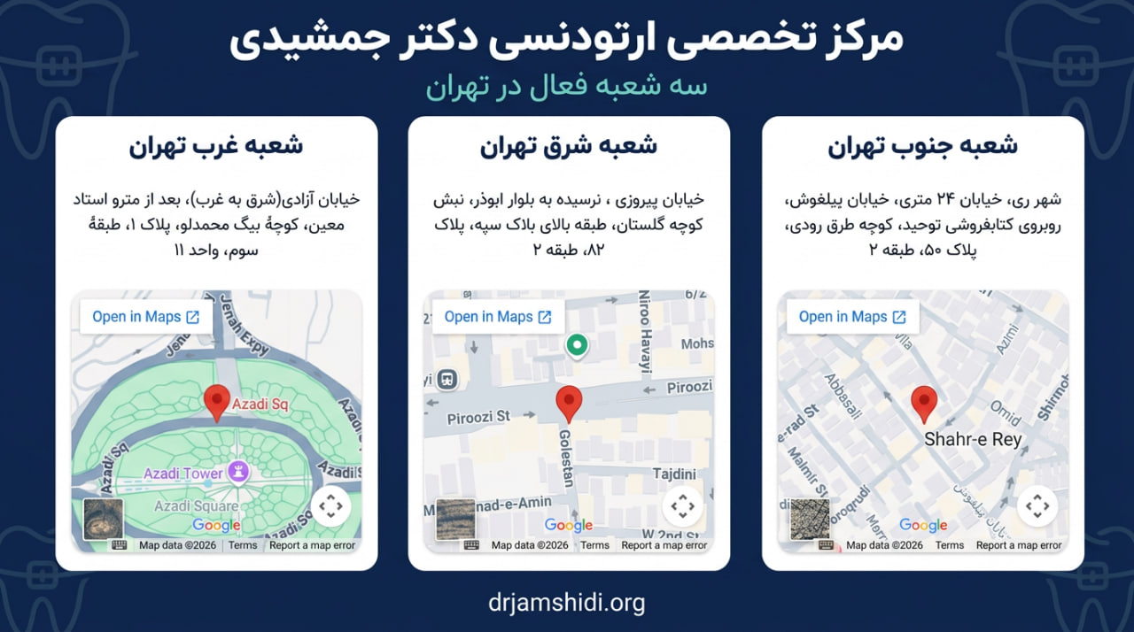 خدمات دکتر جمشیدی در زمینه ارتودنسی