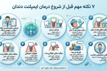 قبل از کاشت ایمپلنت دندان این ۷ نکته را بدانید قبل از کاشت ایمپلنت دندان این ۷ نکته را بدانید