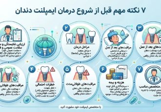قبل از کاشت ایمپلنت دندان این ۷ نکته را بدانید قبل از کاشت ایمپلنت دندان این ۷ نکته را بدانید
