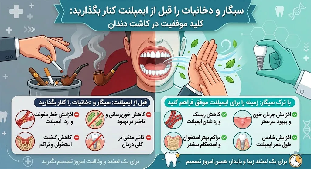 تاثیر سیگار بر ایمپلنت