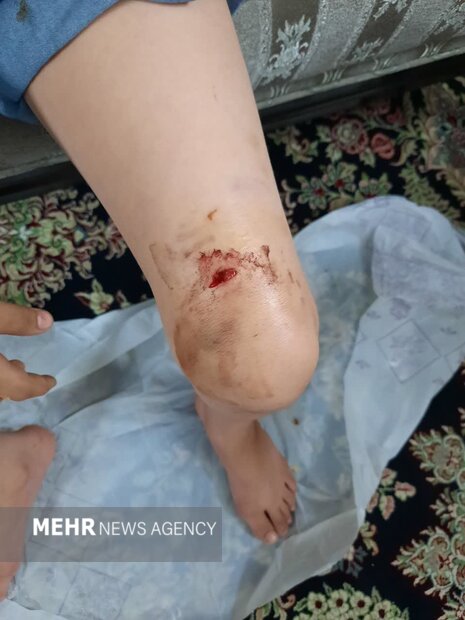 حمله یک سگ ولگرد به ۱۴ شهروند در ورامین/پاسخگوی این معضل کیست؟ حمله یک سگ ولگرد به ۱۴ شهروند در ورامین/پاسخگوی این معضل کیست؟