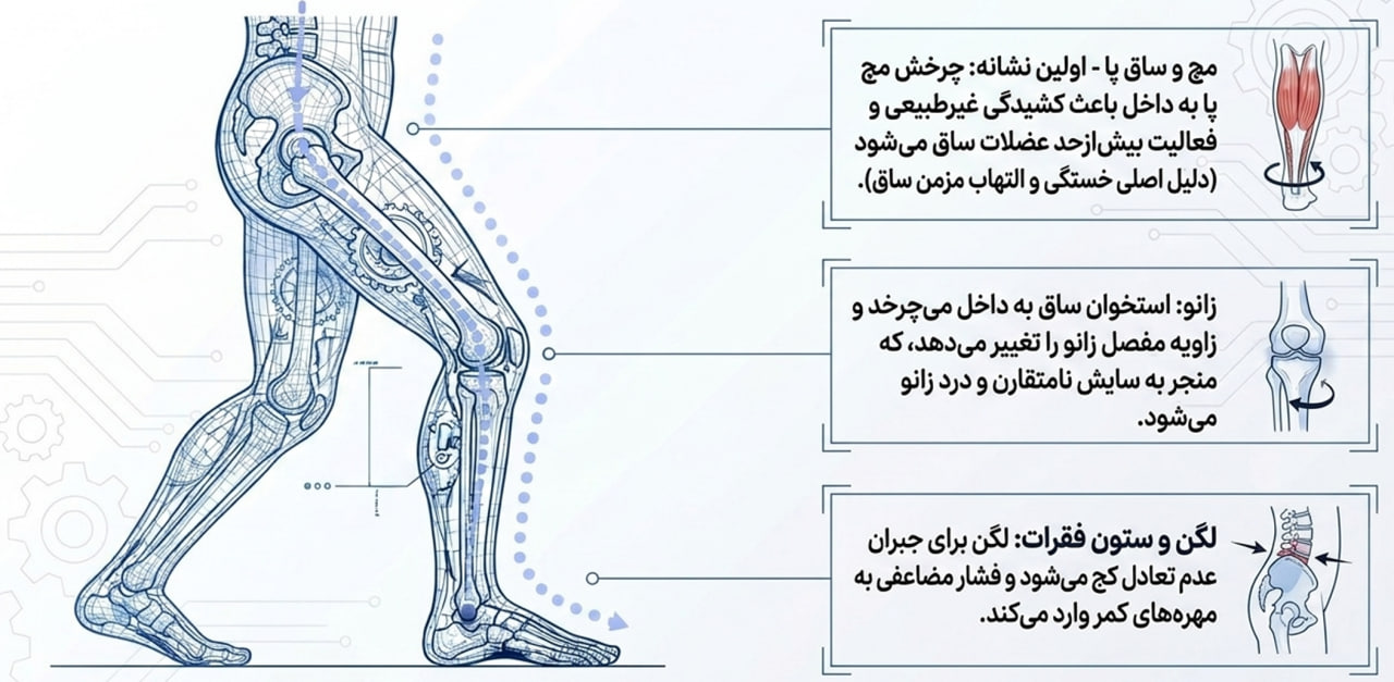 صافی کف پا چگونه بدن را تحت تاثیر قرار میدهد؟ اسکن کف پا برای تشخیص الگوی فشار