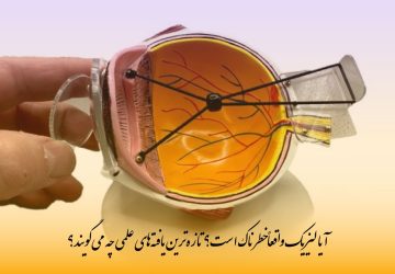 آیا لیزیک واقعاً خطرناک است؟ تازه‌ترین یافته‌های علمی چه می‌گویند؟