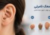 سمعک نامرئی برای چه کسانی مناسب است؟