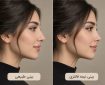 تفاوت عمل بینی طبیعی و نیمه فانتزی دقیقا در چیست؟ تفاوت عمل بینی طبیعی و نیمه فانتزی دقیقا در چیست؟