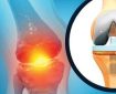 چرا تعداد متقاضیان تعویض مفصل زانو رو به افزایش است؟
