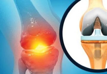 چرا تعداد متقاضیان تعویض مفصل زانو رو به افزایش است؟