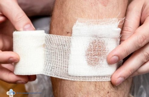 زخم چه زمانی خطرناک می‌شود؟ ۷ نشانه‌ای که مراجعه به متخصص را ضروری می‌کند