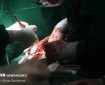 تشریح مهم ترین چالش های پیوند ریه در ایران تشریح مهم ترین چالش های پیوند ریه در ایران